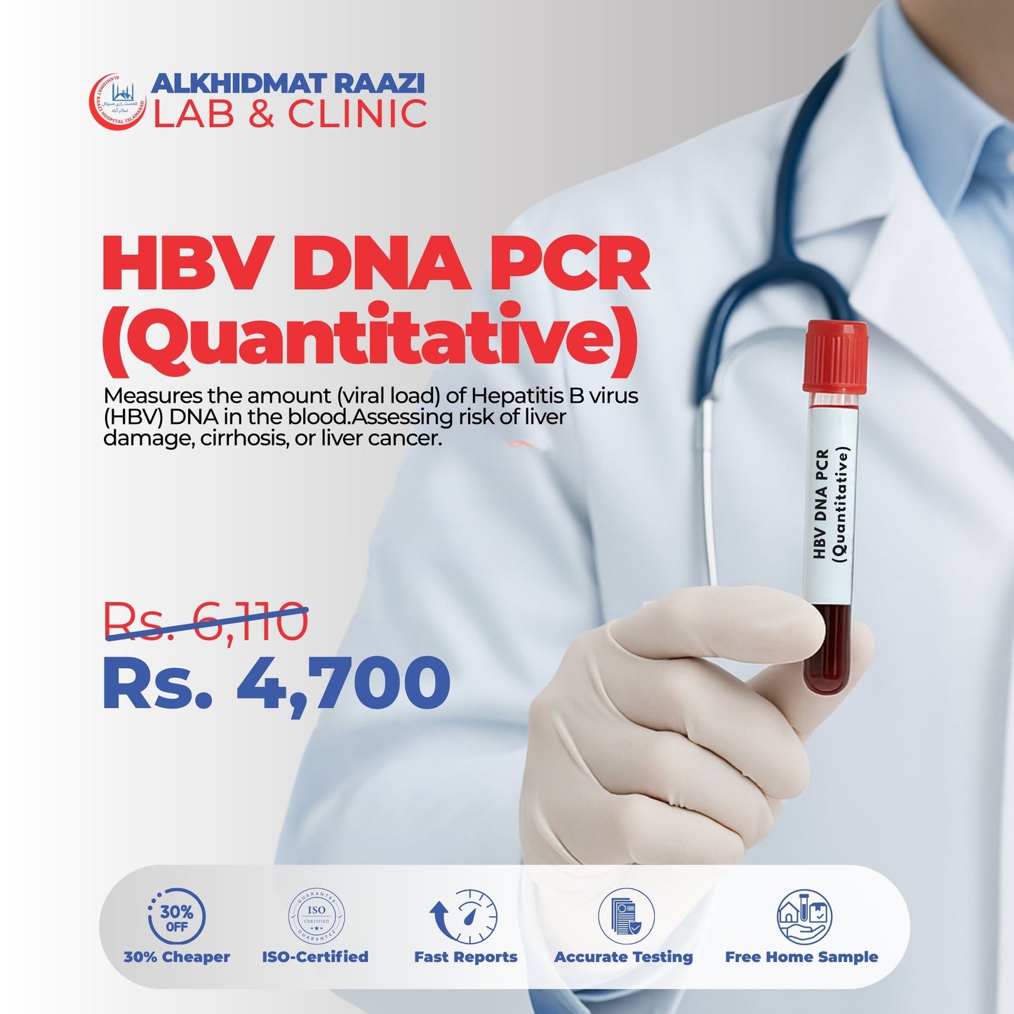 HBV DNA PCR (Quantitative)