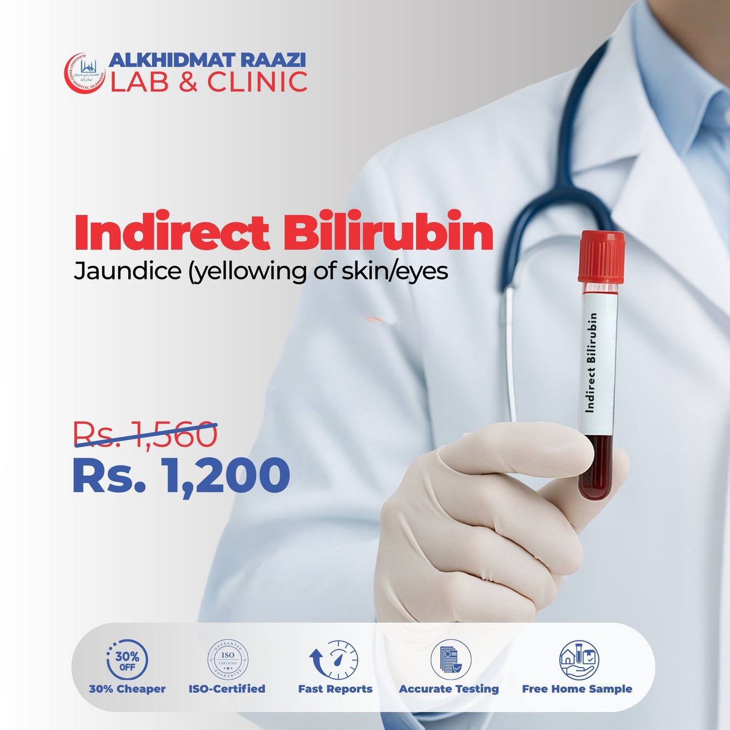 Indirect Bilirubin