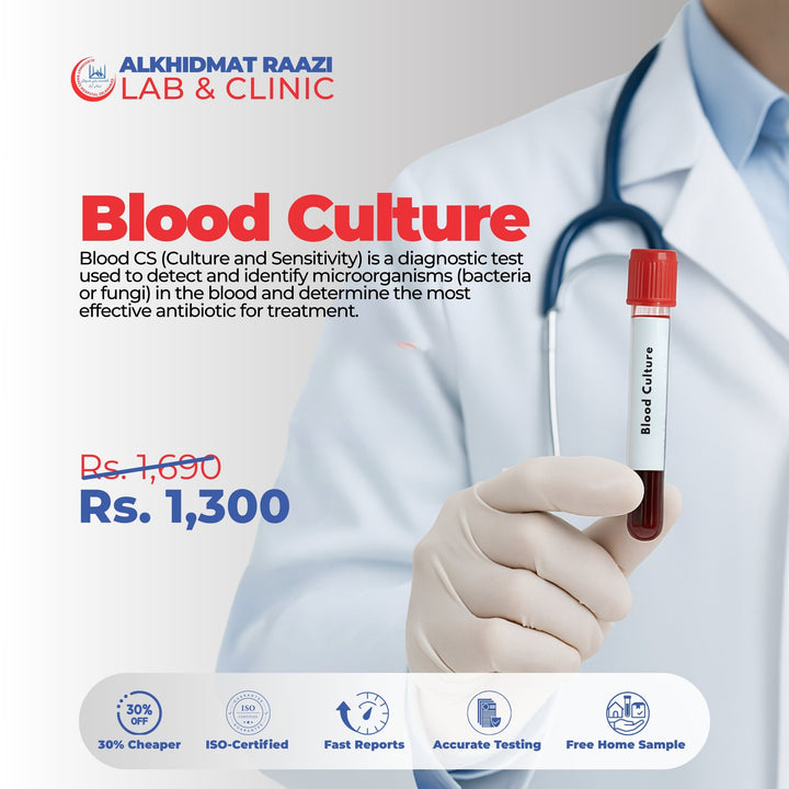 Blood Culture