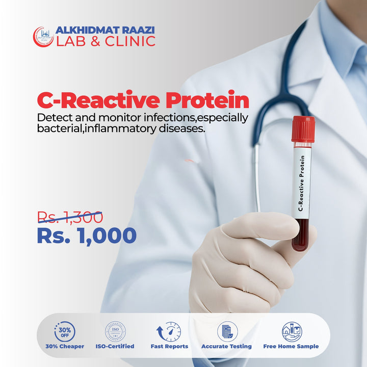 C-Reactive Protein