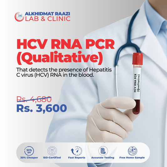 HCV RNA PCR (Qualitative)
