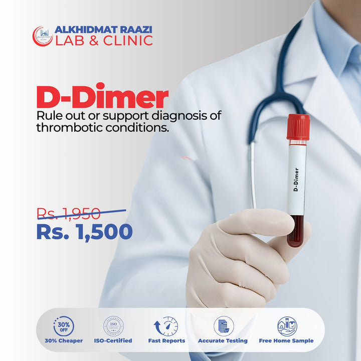 D-Dimer