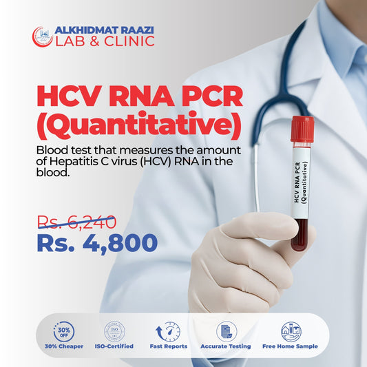 HCV RNA PCR (Quantitative)