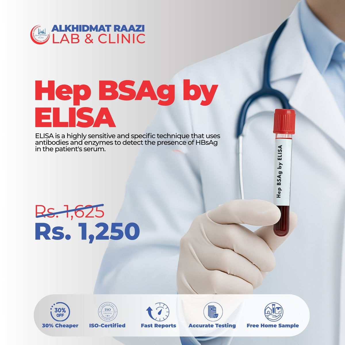 Hep BSAg by ELISA