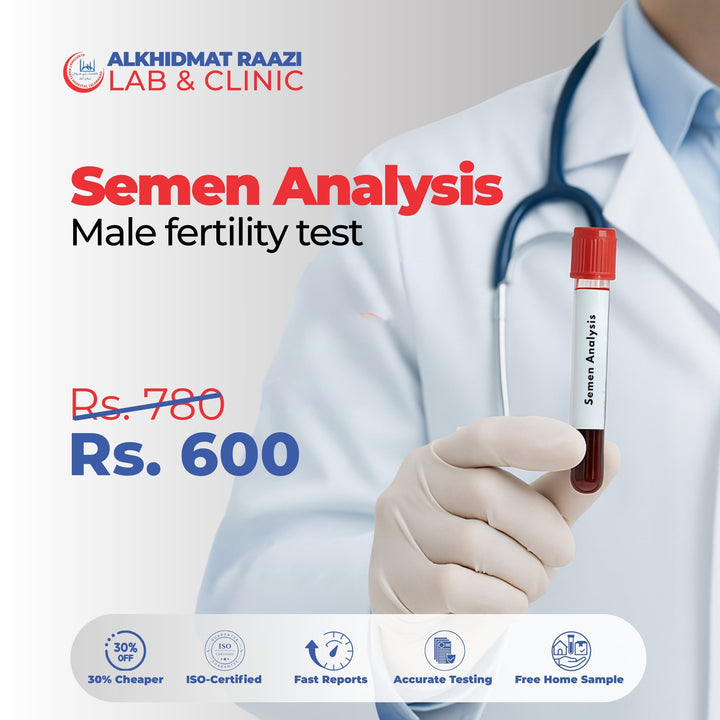 Semen Analysis