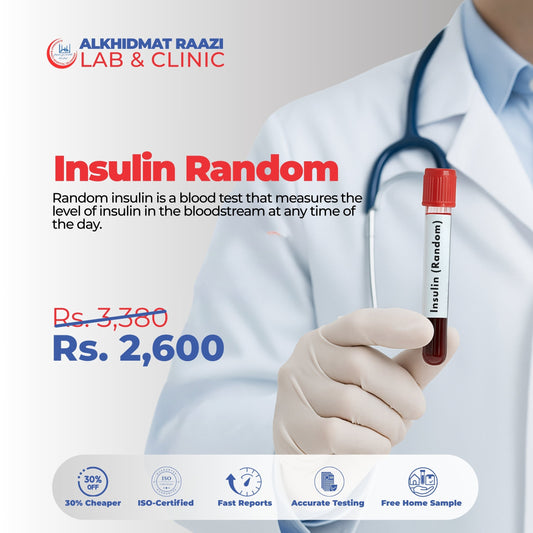 Insulin (Random)
