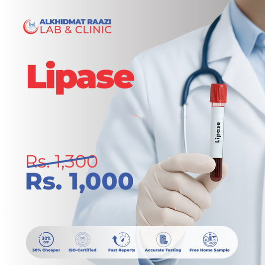 Lipase