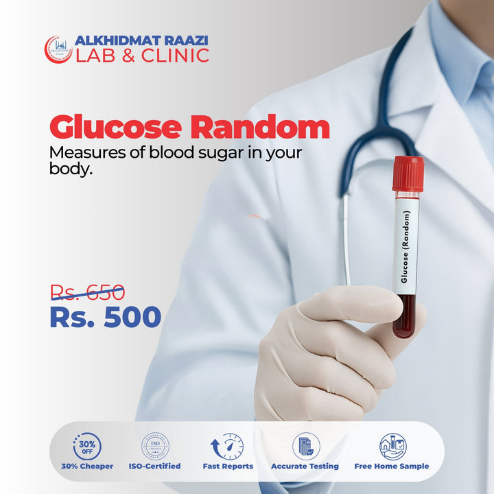 Glucose (Random)