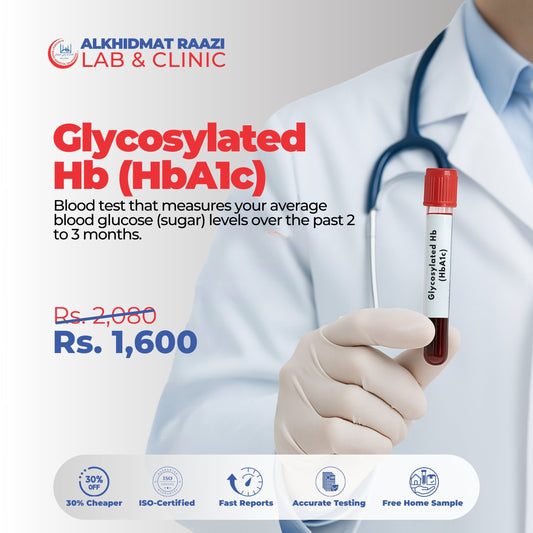 Glycosylated Hb (HbA1c)