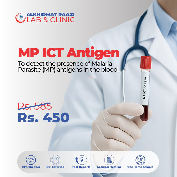 Malaria Antigen by ICT (MP-ICT)