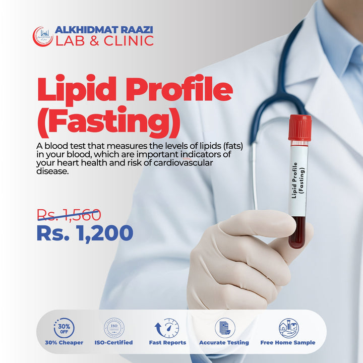 Lipid Profile (Fasting)