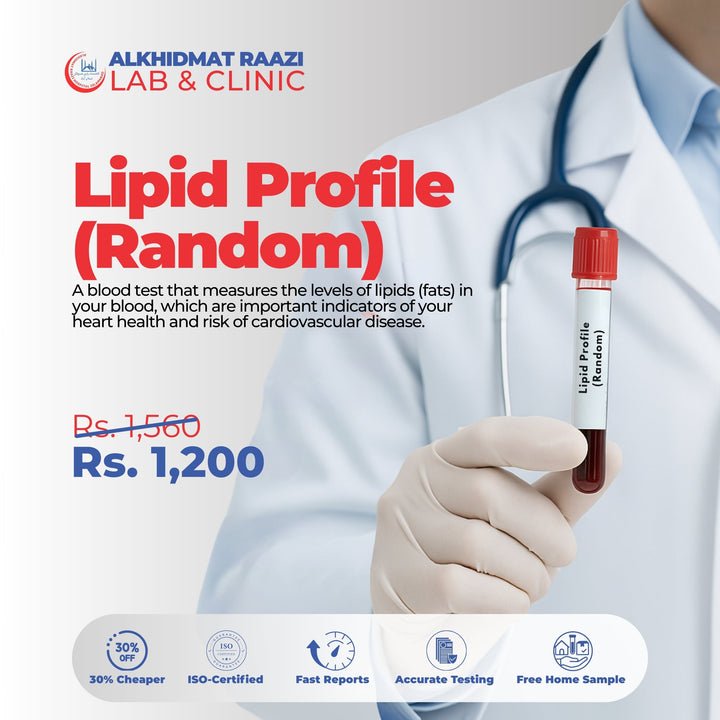 Lipid Profile (Random)