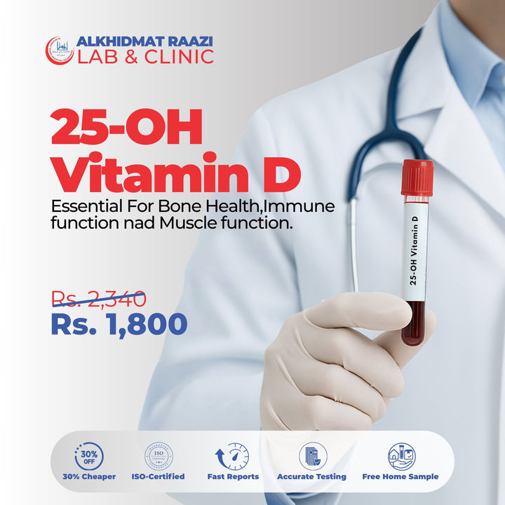 25-OH Vitamin D