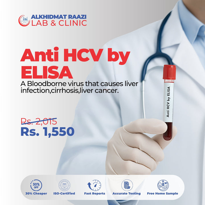 Anti HCV by ELISA